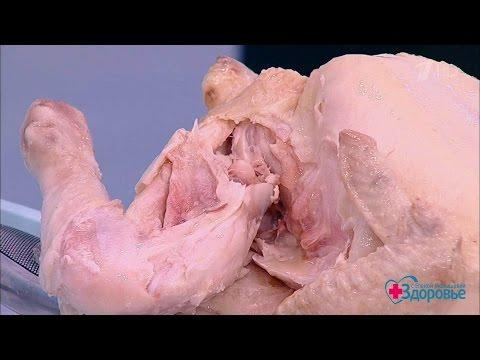 Здоровье. Чем опасно куриное мясо.(05.02.2017)